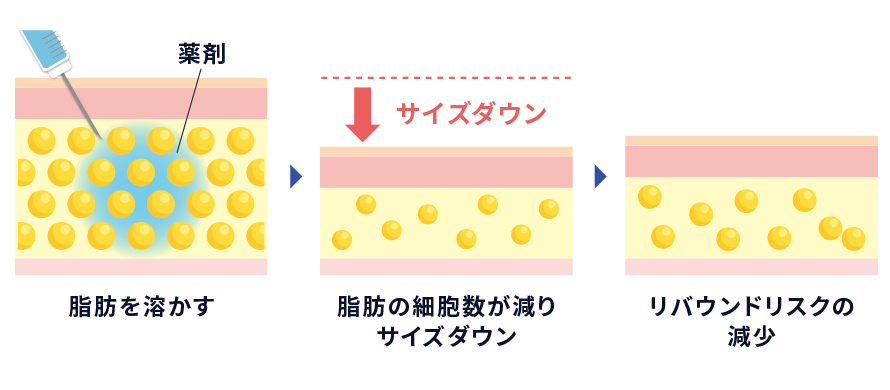 脂肪溶解注射の効果