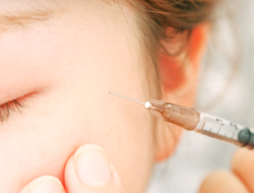 ジュベルックの注入